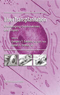 Everson / Trotter |  Liver Transplantation | eBook | Sack Fachmedien