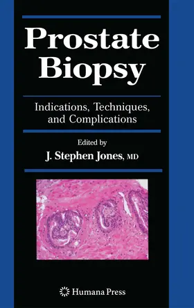 Jones |  Prostate Biopsy | eBook | Sack Fachmedien