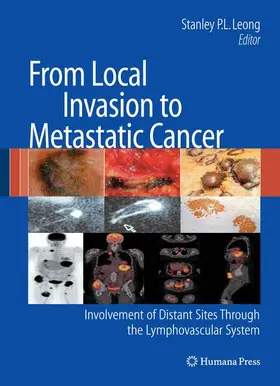 Leong | From Local Invasion to Metastatic Cancer | Buch | 978-1-60327-086-1 | www.sack.de
