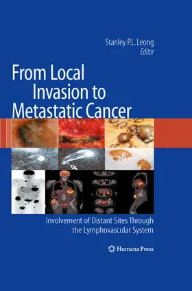 Leong |  From Local Invasion to Metastatic Cancer | eBook | Sack Fachmedien