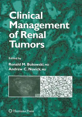 Bukowski / Novick |  Clinical Management of Renal Tumors | eBook | Sack Fachmedien