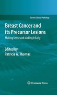 Thomas |  Breast Cancer and its Precursor Lesions | eBook | Sack Fachmedien