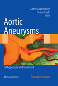 Upchurch Jr. / Criado |  Aortic Aneurysms | eBook | Sack Fachmedien
