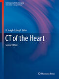Schoepf |  CT of the Heart | eBook | Sack Fachmedien