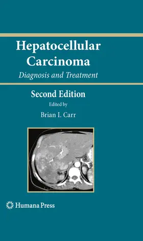 Carr | Hepatocellular Carcinoma | E-Book | www.sack.de