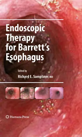 Sampliner | Endoscopic Therapy for Barrett's Esophagus | E-Book | sack.de