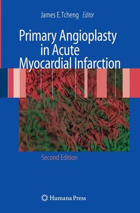 Tcheng | Primary Angioplasty in Acute Myocardial Infarction | Buch | 978-1-60327-496-8 | sack.de