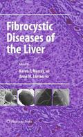 Larson / Murray |  Fibrocystic Diseases of the Liver | Buch |  Sack Fachmedien