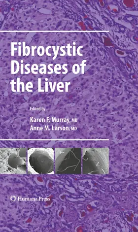 Murray / Larson |  Fibrocystic Diseases of the Liver | eBook | Sack Fachmedien