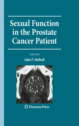Mulhall | Sexual Function in the Prostate Cancer Patient | E-Book | sack.de