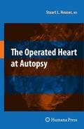 Houser |  The Operated Heart at Autopsy | Buch |  Sack Fachmedien