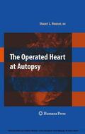 Houser |  The Operated Heart at Autopsy | eBook | Sack Fachmedien