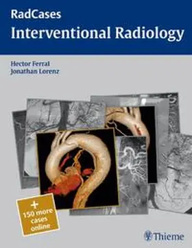 Ferral | Radcases Interventional Radiology | Buch | 978-1-60406-177-2 | sack.de