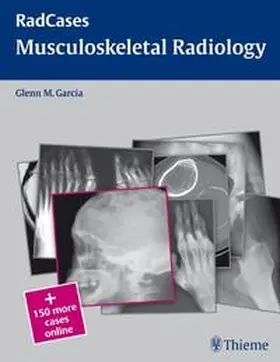Garcia |  Radcases Musculoskeletal Radiology | Buch |  Sack Fachmedien