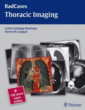 Restrepo / Zangan | Radcases Thoracic Imaging | Buch | 978-1-60406-187-1 | sack.de