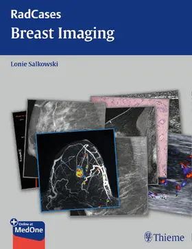 Salkowski |  Radcases Breast Imaging | Buch |  Sack Fachmedien