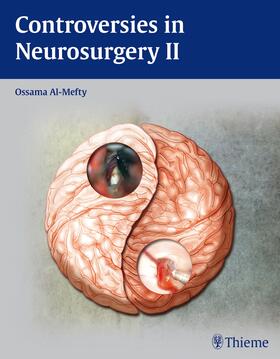 Al-Mefty | Controversies in Neurosurgery II | E-Book | sack.de