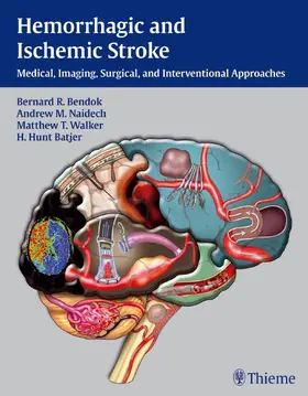 Bendok / Naidech / Batjer |  Hemorrhagic and Ischemic Stroke | Buch |  Sack Fachmedien