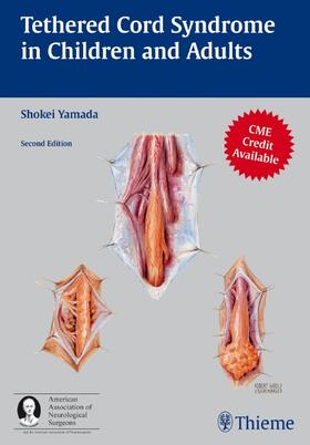 Yamada | Tethered Cord Syndrome in Children and Adults | Buch | sack.de