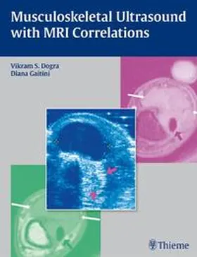 Dogra / Gaitini | Musculoskeletal Ultrasound with MRI Correlations | Buch | 978-1-60406-244-1 | www.sack.de