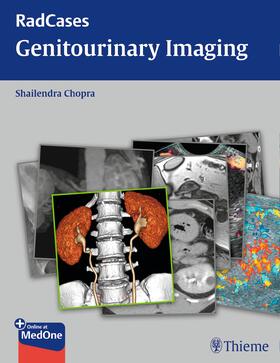 Chopra | Radcases Genitourinary Imaging | Buch | 978-1-60406-324-0 | sack.de