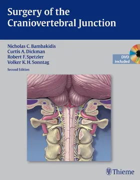 Bambakidis / Dickman / Spetzler | Surgery of the Craniovertebral Junction | E-Book | www.sack.de