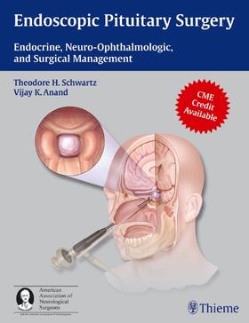 Schwartz / Anand | Endoscopic Pituitary Surgery | E-Book | sack.de