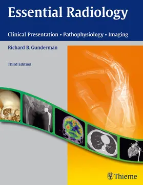 Gunderman |  Essential Radiology | Buch |  Sack Fachmedien