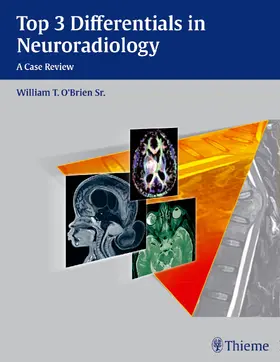 O'Brien | Top 3 Differentials in Neuroradiology | Buch | 978-1-60406-723-1 | www.sack.de