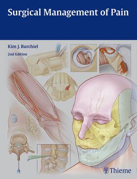 Burchiel |  Surgical Management of Pain | eBook | Sack Fachmedien
