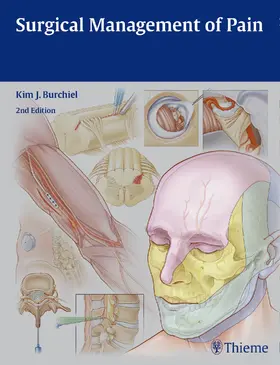 Burchiel |  Surgical Management of Pain | eBook | Sack Fachmedien