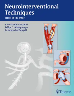 Gonzalez / Albuquerque / McDougall | Neurointerventional Techniques | Buch | 978-1-60406-757-6 | www.sack.de