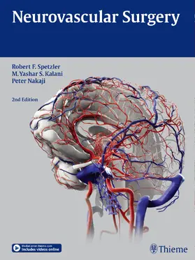 Spetzler / Kalani / Nakaji |  Neurovascular Surgery | Buch |  Sack Fachmedien