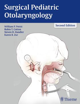Potsic / Cotton / Handler | Surgical Pediatric Otolaryngology | E-Book | sack.de