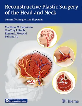 Hanasono / Robb / Skoracki |  Reconstructive Plastic Surgery of the Head and Neck | eBook | Sack Fachmedien