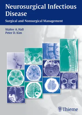 Hall / Kim | Neurosurgical Infectious Disease | E-Book | www.sack.de