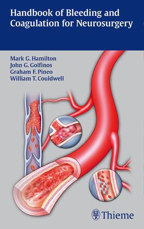 Hamilton / Couldwell / Golfinos |  Handbook of Bleeding and Coagulation for Neurosurgery | eBook | Sack Fachmedien