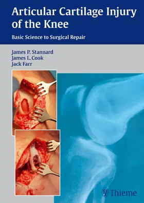 Stannard / Cook / Farr |  Articular Cartilage Injury of the Knee: Basic Science to Surgical Repair | eBook | Sack Fachmedien