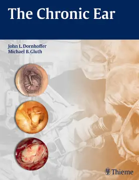 Dornhoffer / Gluth |  The Chronic Ear | Buch |  Sack Fachmedien