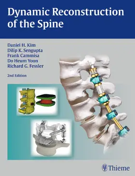 Kim / Cammisa / Fessler |  Dynamic Reconstruction of the Spine | Buch |  Sack Fachmedien