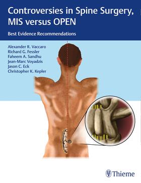 Vaccaro / Fessler / Sandhu | Controversies in Spine Surgery, MIS versus OPEN | E-Book | sack.de