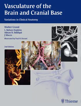 Grand / Hopkins / Siddiqui | Vasculature of the Brain and Cranial Base | E-Book | www.sack.de