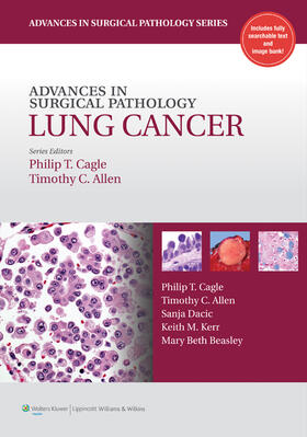 Cagle / Allen | Advances in Surgical Pathology: Lung Cancer | Buch | 978-1-60547-591-2 | sack.de