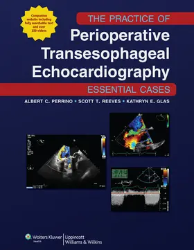 Perrino / Reeves / Glas |  The Practice of Perioperative Transesophageal Echocardiography: Essential Cases | Buch |  Sack Fachmedien