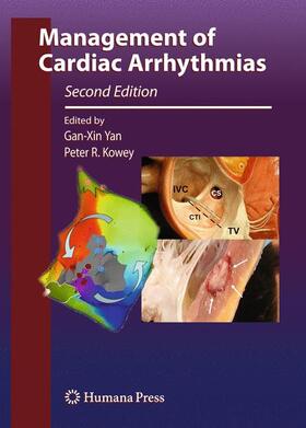 Yan / Kowey |  Management of Cardiac Arrhythmias | Buch |  Sack Fachmedien