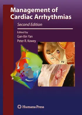 Yan / Kowey |  Management of Cardiac Arrhythmias | eBook | Sack Fachmedien