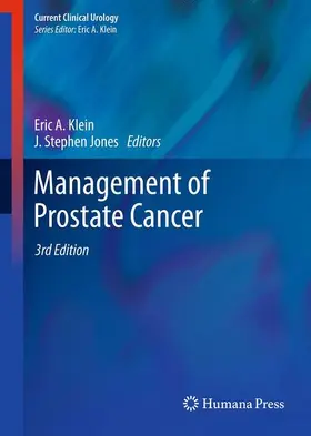 Klein / Jones |  Management of Prostate Cancer | Buch |  Sack Fachmedien