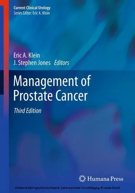 Klein / Jones |  Management of Prostate Cancer | eBook | Sack Fachmedien