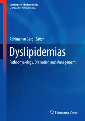 Garg | Dyslipidemias | E-Book | www.sack.de