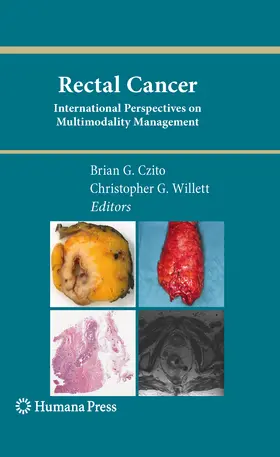 Czito / Willett | Rectal Cancer | E-Book | www.sack.de